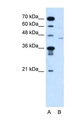 Western Blot: FKTN Antibody [NBP1-59640]