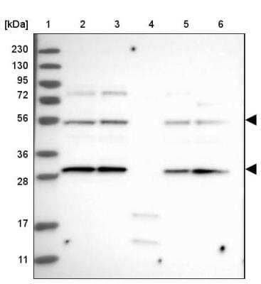 Western Blot: FLAD1 Antibody [NBP1-84752]