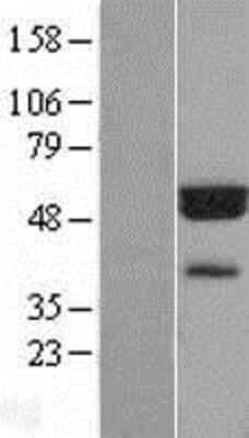 Western Blot: FLAD1 Overexpression Lysate [NBL1-10746]