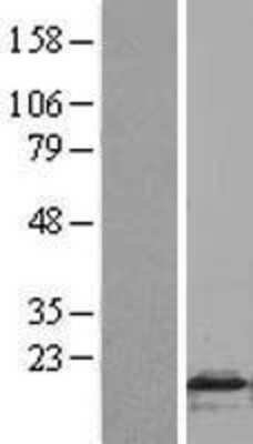 Western Blot: FLAP Overexpression Lysate [NBL1-07484]