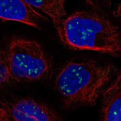 Immunocytochemistry/ Immunofluorescence: FLASH Antibody [NBP2-58151]