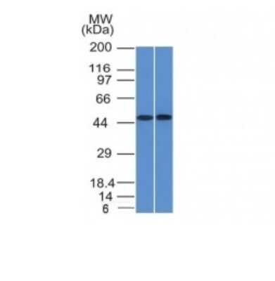 Western Blot: FLI1 Antibody (FLI1/1312)BSA Free [NBP2-54423]