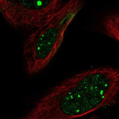 Immunocytochemistry/ Immunofluorescence: FLI1 Antibody [NBP2-57756]