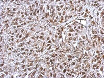Immunohistochemistry-Paraffin: FLI1 Antibody [NBP2-16500]
