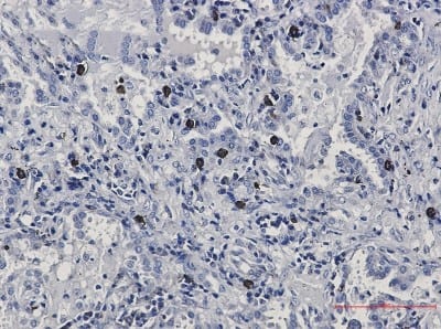 Immunohistochemistry-Paraffin: FLI1 Antibody (S01-0C2) [NBP3-19635]