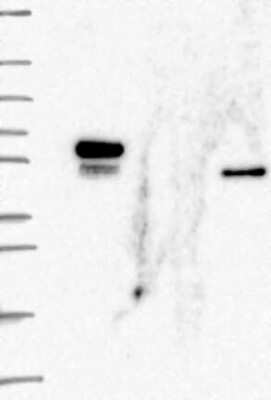 Western Blot: FLI1 Antibody [NBP3-17205]