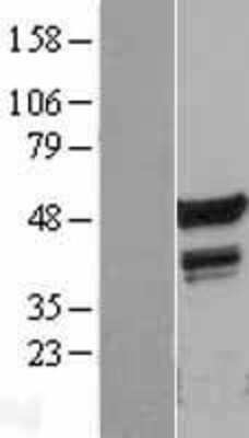 Western Blot: FLI1 Overexpression Lysate [NBL1-10748]