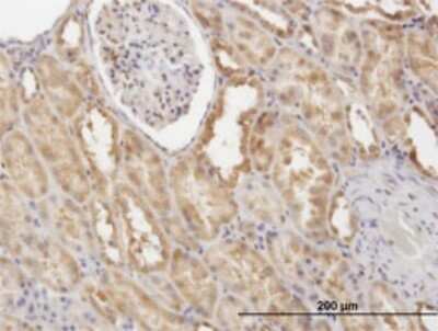 Immunohistochemistry-Paraffin: FLIP Antibody (2F12) [H00008837-M01]