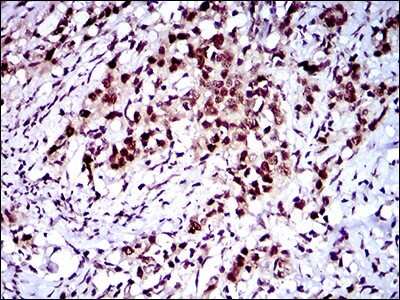 Immunohistochemistry-Paraffin: FLIP Antibody (7A3D12) - BSA Free [NBP2-37359]