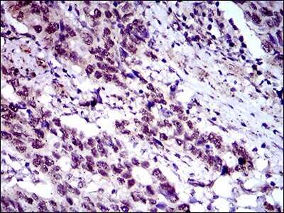 Immunohistochemistry-Paraffin: FLIP Antibody (7A3D12) - BSA Free [NBP2-37359]