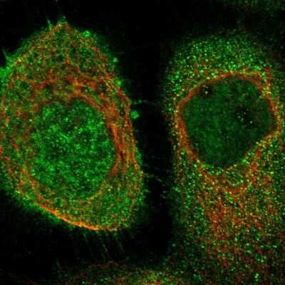 Immunocytochemistry/ Immunofluorescence: FLIP Antibody [NBP1-85675]