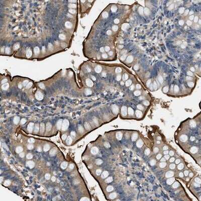 Immunohistochemistry-Paraffin: FLIP Antibody [NBP1-85675]