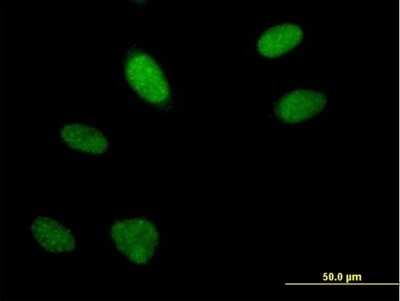 Immunocytochemistry/ Immunofluorescence: FLJ10154 Antibody [H00055082-B01P]
