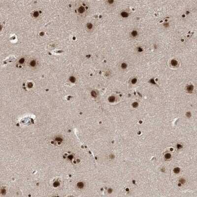 Immunohistochemistry-Paraffin: FLJ10154 Antibody [NBP1-87921]