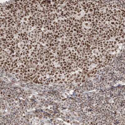 Immunohistochemistry-Paraffin: FLJ10154 Antibody [NBP1-87921]