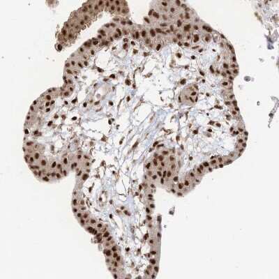 Immunohistochemistry-Paraffin: FLJ10154 Antibody [NBP1-87921]