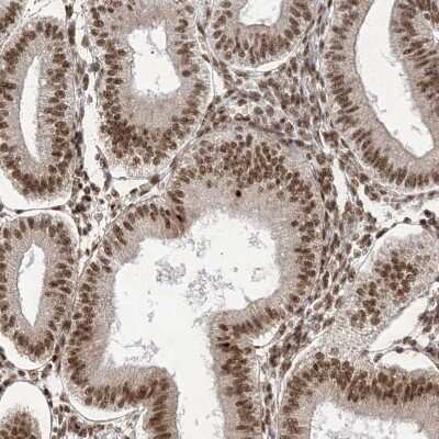 Immunohistochemistry-Paraffin: FLJ10154 Antibody [NBP1-87921]