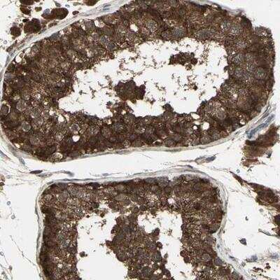 Immunohistochemistry-Paraffin: FLJ10769 Antibody [NBP1-87916]