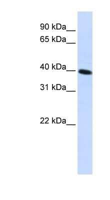 Western Blot: FLJ10769 Antibody [NBP1-62516]