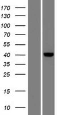 Western Blot: FLJ10769 Overexpression Lysate [NBP2-06851]