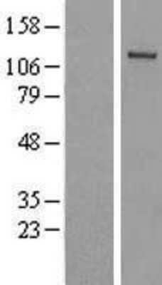 Western Blot: FLJ10808 Overexpression Lysate [NBL1-17501]