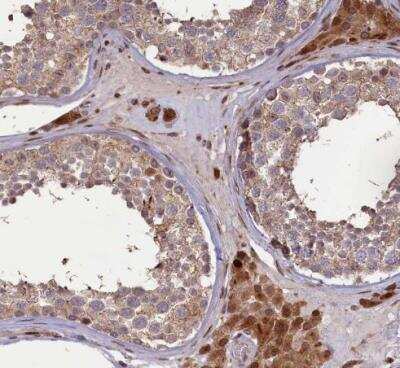 Immunohistochemistry-Paraffin: FLJ10815 Antibody [NBP1-87910]