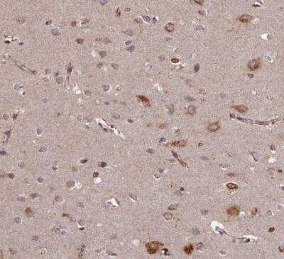 Immunohistochemistry-Paraffin: FLJ10815 Antibody [NBP1-87910]