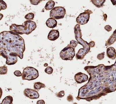 Immunohistochemistry-Paraffin: FLJ10815 Antibody [NBP1-87910]