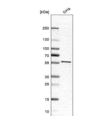 Western Blot: FLJ10815 Antibody [NBP1-87910]