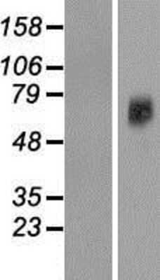 Western Blot: FLJ10815 Overexpression Lysate [NBP2-06847]