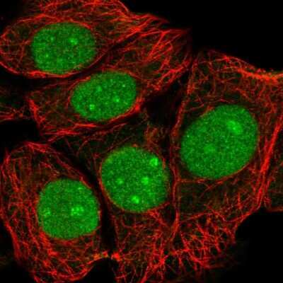 Immunocytochemistry/ Immunofluorescence: FLJ11184 Antibody [NBP2-55828]