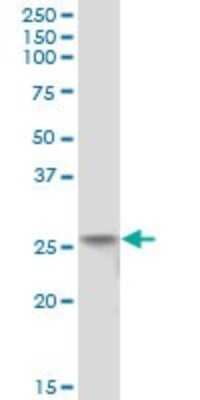 Western Blot: FLJ11184 Antibody [H00055319-B01P]