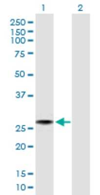 Western Blot: FLJ11184 Antibody [H00055319-B01P]