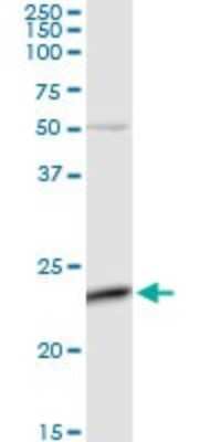 Western Blot: FLJ11184 Antibody [H00055319-D01P]