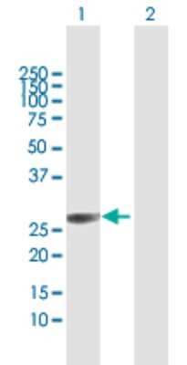 Western Blot: FLJ11184 Antibody [H00055319-D01P]