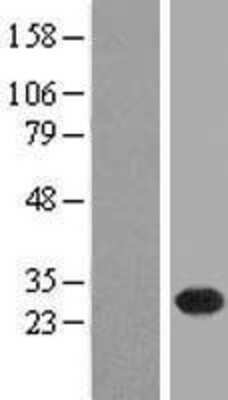 Western Blot: FLJ11184 Overexpression Lysate [NBL1-08480]