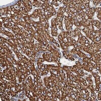 Immunohistochemistry-Paraffin: FLJ11506 Antibody [NBP1-87906]