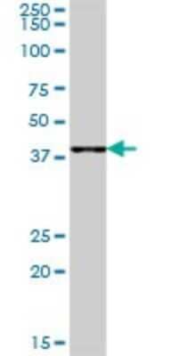 Western Blot: FLJ11506 Antibody [H00079719-B01P]