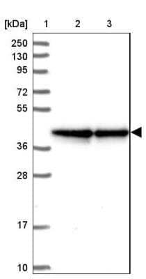 Western Blot: FLJ11506 Antibody [NBP1-87905]