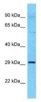 Western Blot: FLJ11506 Antibody [NBP3-09938]