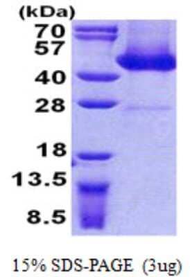 SDS-PAGE: Recombinant Human FLJ11506 His Protein [NBP2-22681]