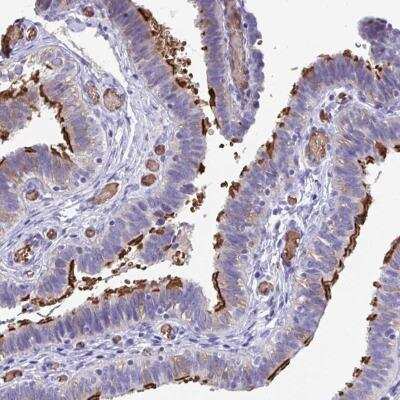 Immunohistochemistry: FLJ13946 Antibody [NBP2-46799]