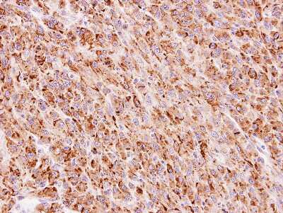 Immunohistochemistry-Paraffin: FLJ13946 Antibody [NBP1-32574]