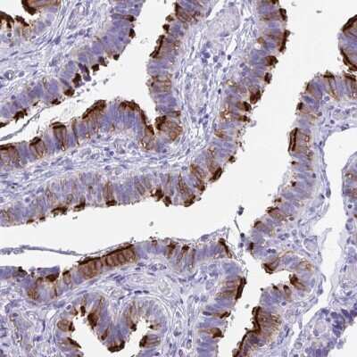 Immunohistochemistry-Paraffin: FLJ13946 Antibody [NBP2-46792]
