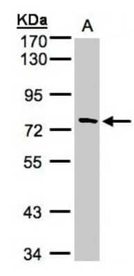 Western Blot: FLJ13946 Antibody [NBP1-32574]