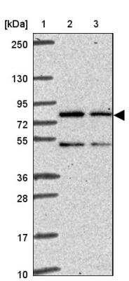 Western Blot: FLJ13946 Antibody [NBP2-46792]