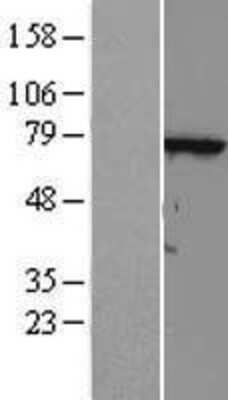 Western Blot: FLJ13946 Overexpression Lysate [NBL1-17405]