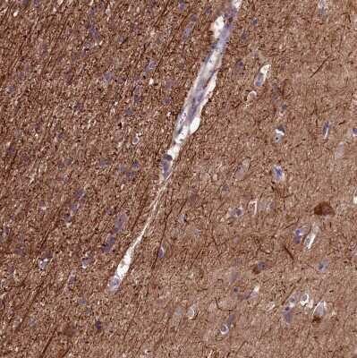 Immunohistochemistry-Paraffin: FLJ14154 Antibody [NBP1-91904]