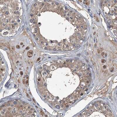 Immunohistochemistry-Paraffin: FLJ14154 Antibody [NBP1-91904]