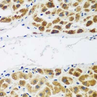 Immunohistochemistry-Paraffin: FLJ14154 Antibody - BSA Free [NBP3-03383]